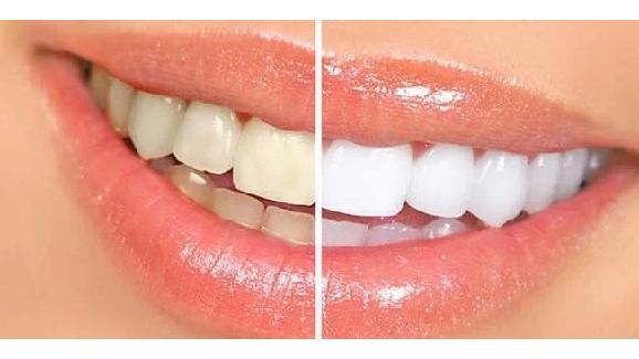 Corona Family Dental at Spring Forest in Lakewood Ranch, FL